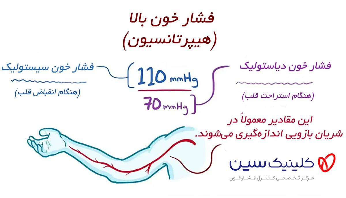 فشار خون 