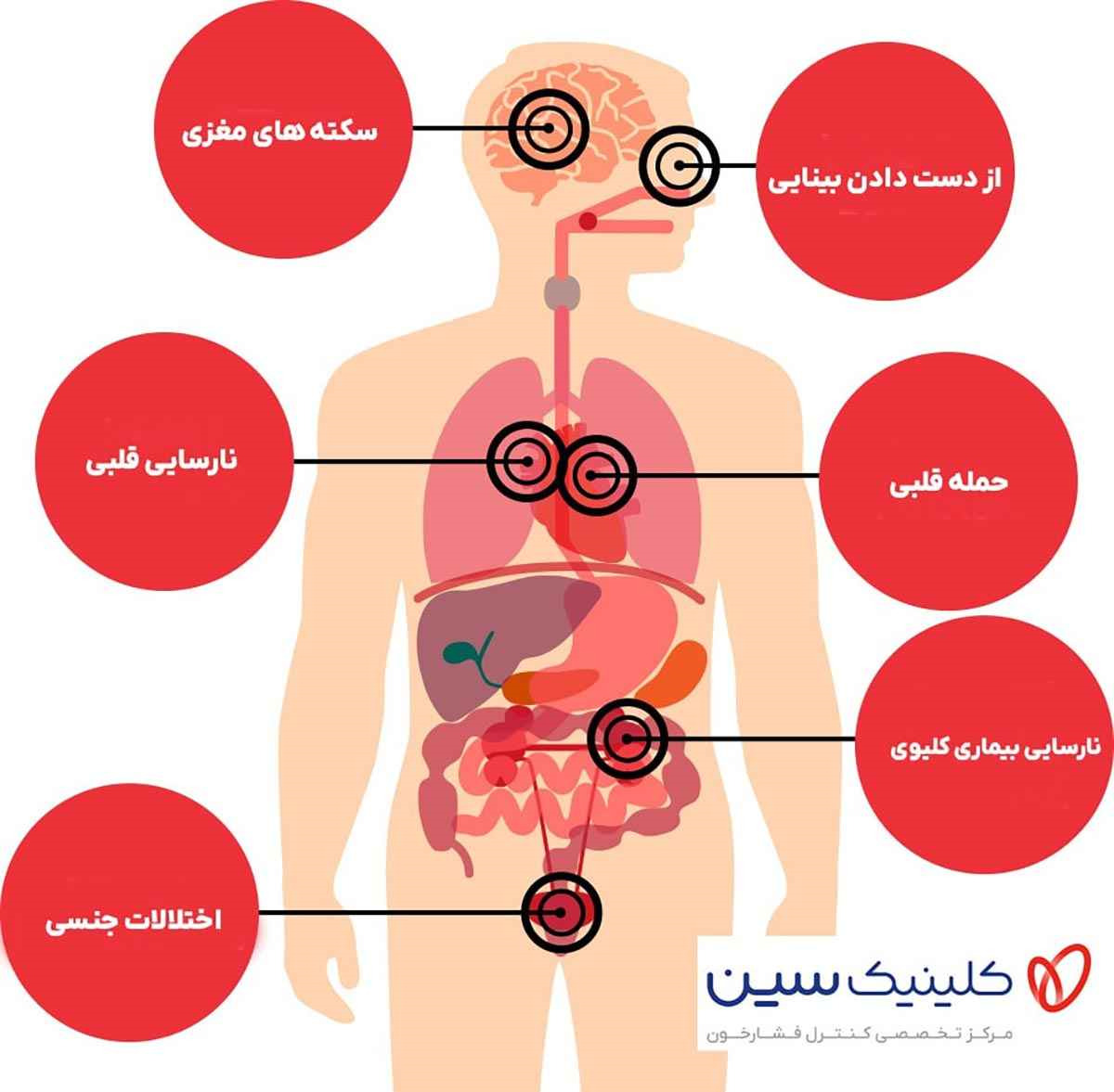 عوارض فشار خون بالا