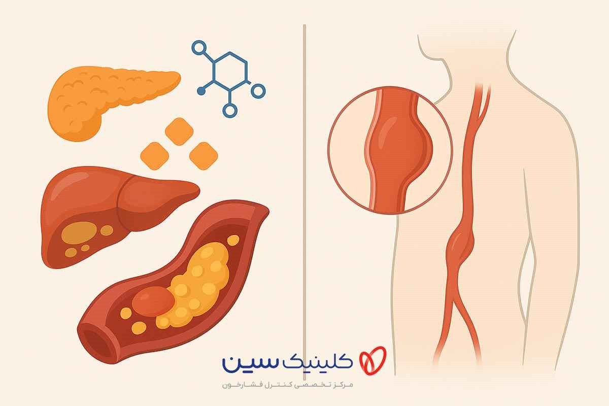 دیابت