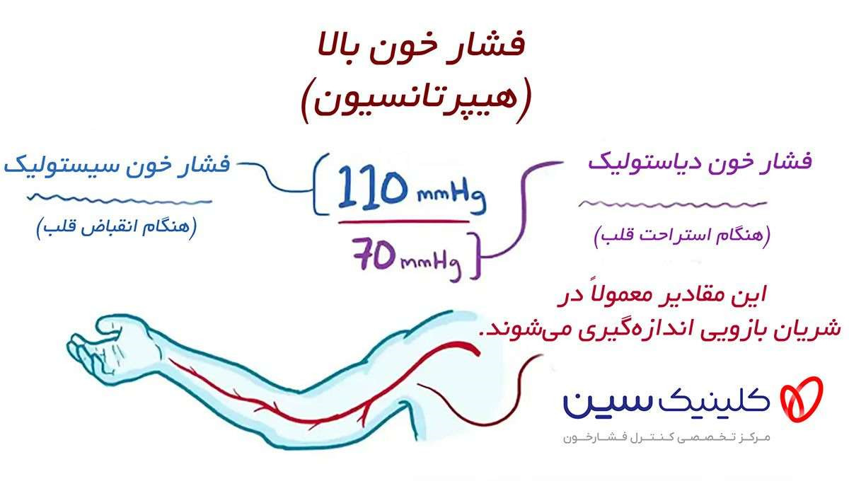 فشار خون چیست؟